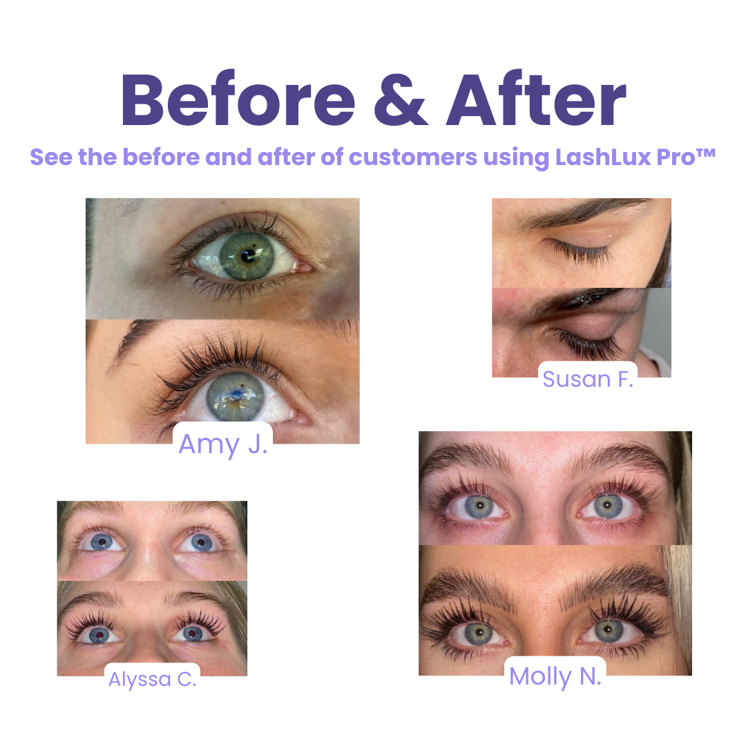 LashLux Pro™ - Eyelash Growth Serum